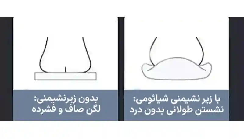زیر نشیمنی طبی شیائومی مدل Leravan LJ-SE002-MGY - تصویر توضیحات 4