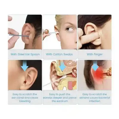 مقایسه گوش پاک کن Bebird R1 با ابزار فلزی پنبه و انگشت